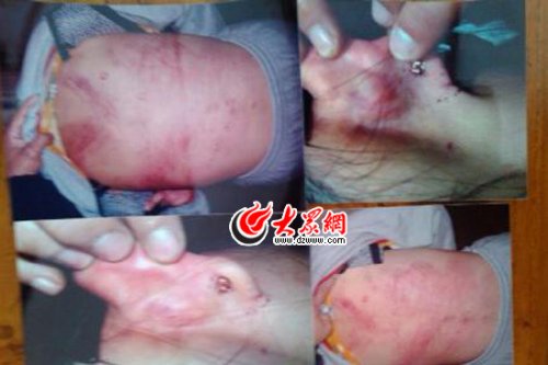 　山東藝術(shù)設(shè)計學院16歲女生宿舍內(nèi)被女同學暴打4小時。