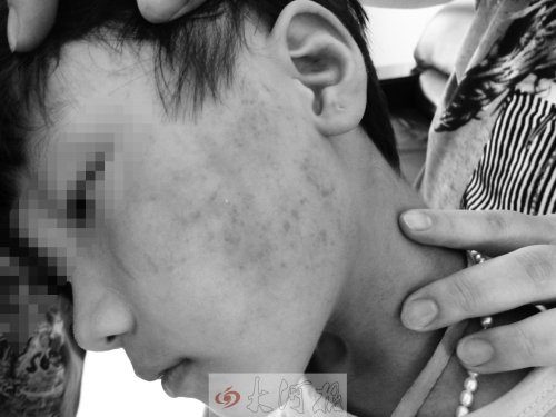 10歲女童向同學(xué)施暴 扇耳光擠肚子強迫舔腳趾