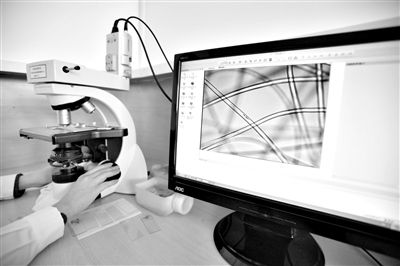 顯微鏡下，聚酯纖維很光亮，表面有斑點(diǎn)，粗細(xì)非常均勻。