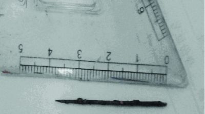 取出的繡花針已發(fā)黑生銹。