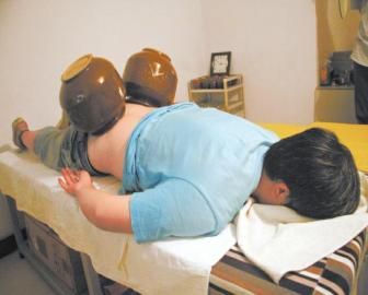 拔泡菜壇子火罐。