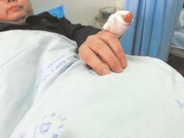 實(shí)習(xí)醫(yī)生陳洪左手的小拇指肌腱斷裂。