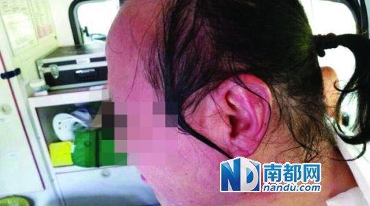 涉事教師遭熱水潑臉后的照片。