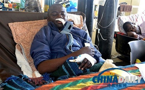 雖然已經(jīng)在醫(yī)院接受了近一個月的恢復治療，卡托卡的身體仍然非常虛弱。