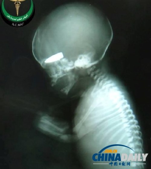 外媒曝敘軍拿孕婦當(dāng)游戲標(biāo)靶 射死胎兒獲香煙 外媒曝敘軍拿孕婦當(dāng)游戲標(biāo)靶 射死胎兒獲香煙