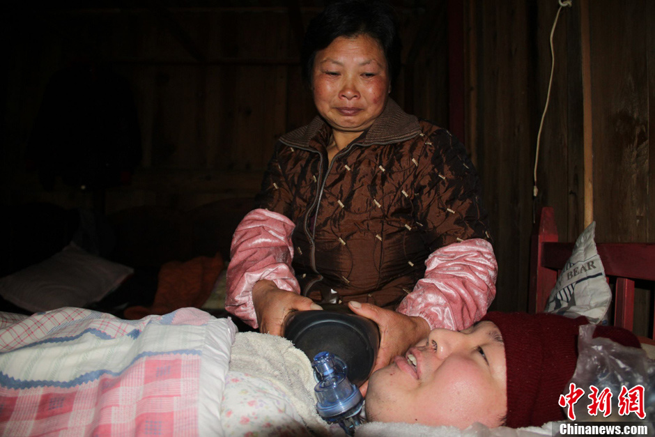 父母為癱瘓兒子自制呼吸機(jī) 手捏呼吸球5年不輟 父母為癱瘓兒子自制呼吸機(jī) 手捏呼吸球5年不輟