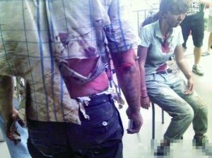 廈門(mén)公交起火爆炸已造成48人死亡 約30人受傷