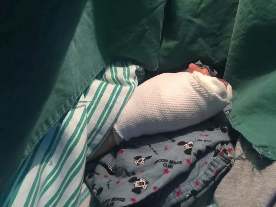 嚇哭！6歲男孩被夾斷手指 罪魁禍?zhǔn)拙故切７? oldsrc=