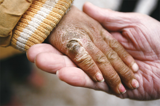 胡天格凍裂的小手撥動了許多讀者的心弦 胡天格凍裂的小手撥動了許多讀者的心弦