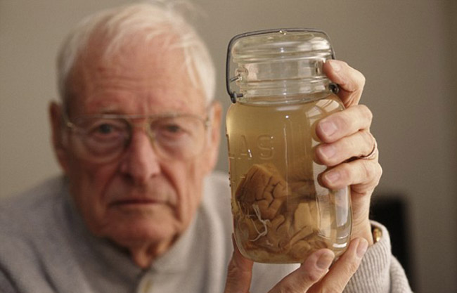 愛因斯坦大腦切片 愛因斯坦大腦切片