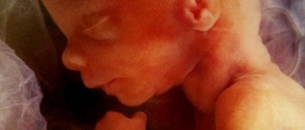 科學(xué)家研發(fā)可在子宮內(nèi)為胎兒做手術(shù)機器人 科學(xué)家研發(fā)可在子宮內(nèi)為胎兒做手術(shù)機器人