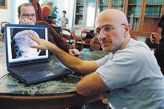 圖為卡納維洛醫(yī)生，不少人認(rèn)為他的想法非常瘋狂