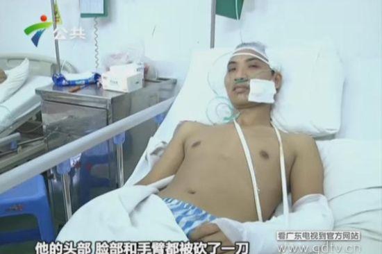 另一名傷者頭部、臉部和手臂都被砍了一刀。(視頻截圖)