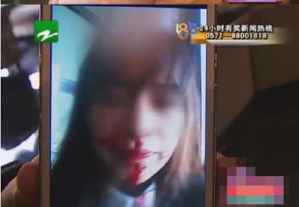 24歲女大學(xué)生被包養(yǎng) 意外懷孕遭對(duì)方帶人圍毆 24歲女大學(xué)生被包養(yǎng) 意外懷孕遭對(duì)方帶人圍毆