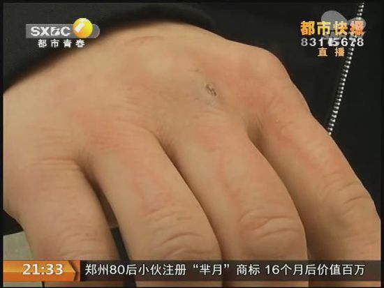 說(shuō)到這足療拔罐，估計(jì)大伙都不陌生，但是想起4號(hào)晚上的拔罐的經(jīng)歷，呂先生現(xiàn)在想起來(lái)，還心有余悸。