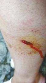 郭女士腿上被猴子咬的傷口。(受訪者供圖)