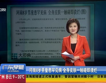 河南8歲男童患罕見(jiàn)病 全身皮膚一觸碰即潰爛