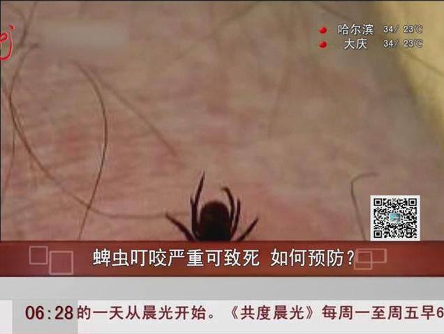 蜱蟲(chóng)叮咬嚴(yán)重可致死如何預(yù)防？