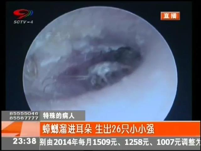 小強(qiáng)溜進(jìn)耳朵？生26只小小強(qiáng)