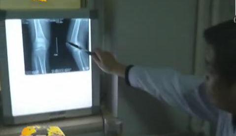 冷空氣來襲 如何預防老寒腿？