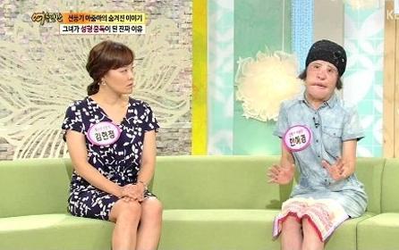 美女整容變“電風(fēng)扇大媽” 盤點整容失敗驚悚案例